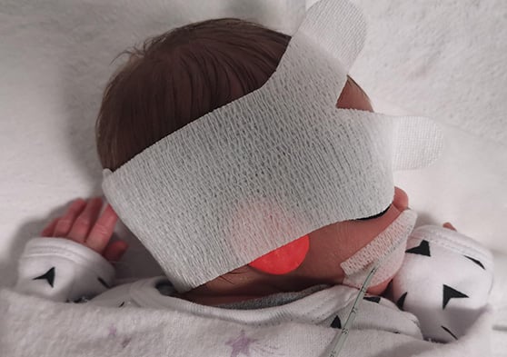 A sleeping infant with a mask on
